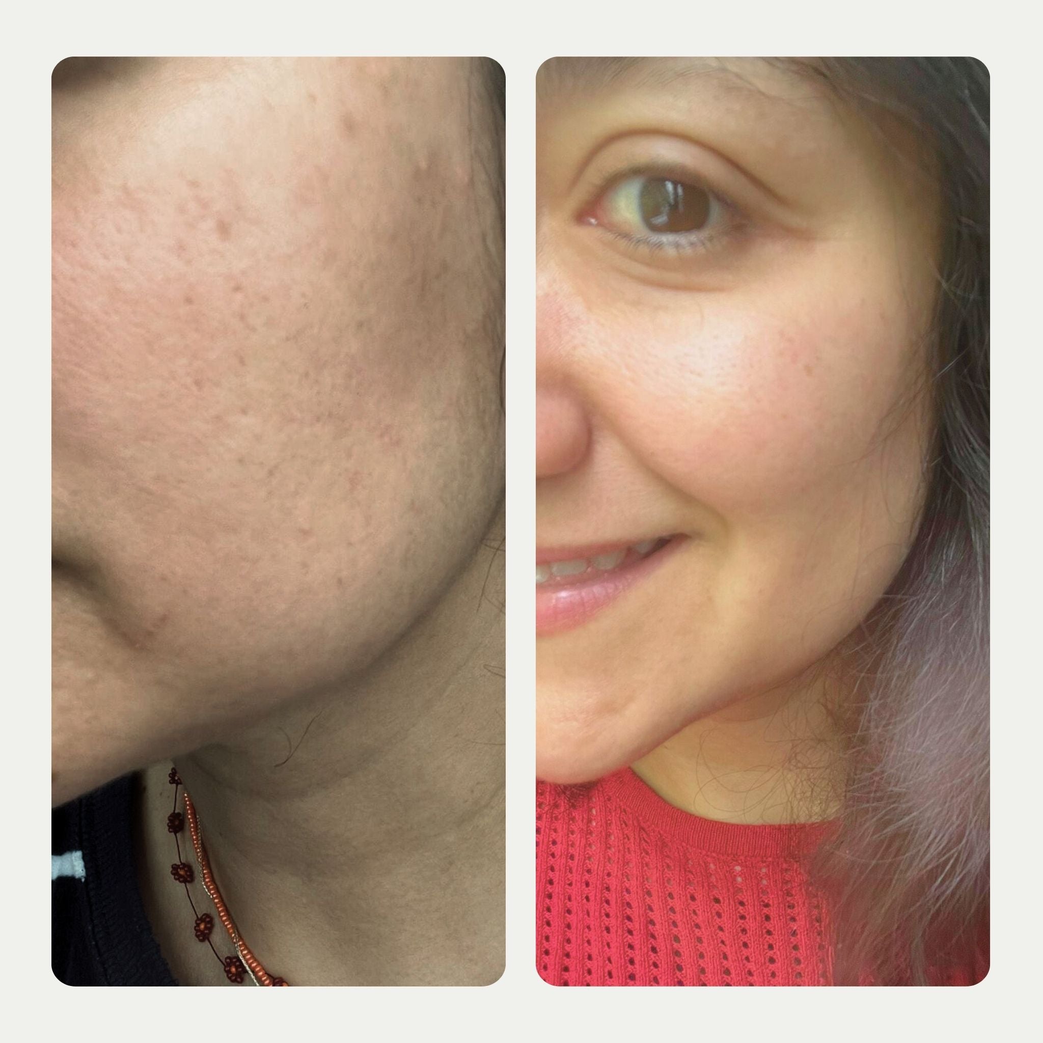 Daily Dose - Vitamin C Serum