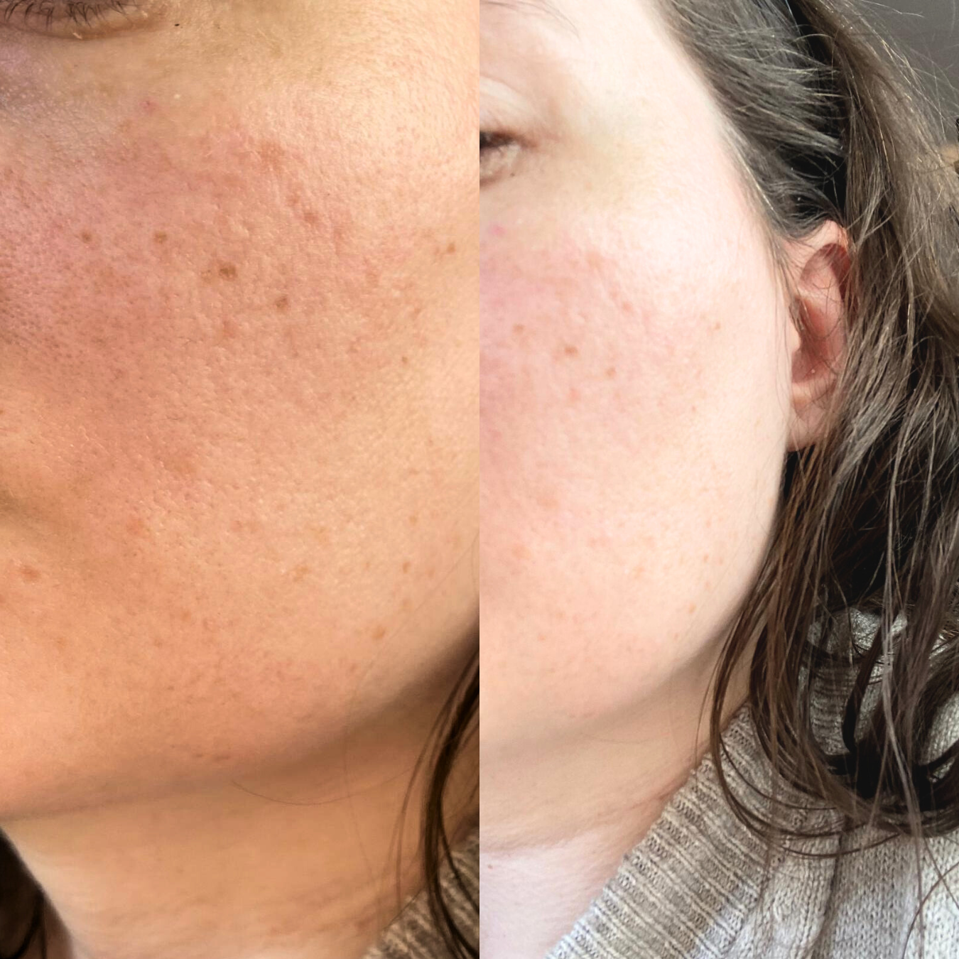 The One - Multi-Active Moisturizer