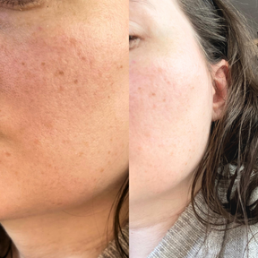 The One - Multi-Active Moisturizer
