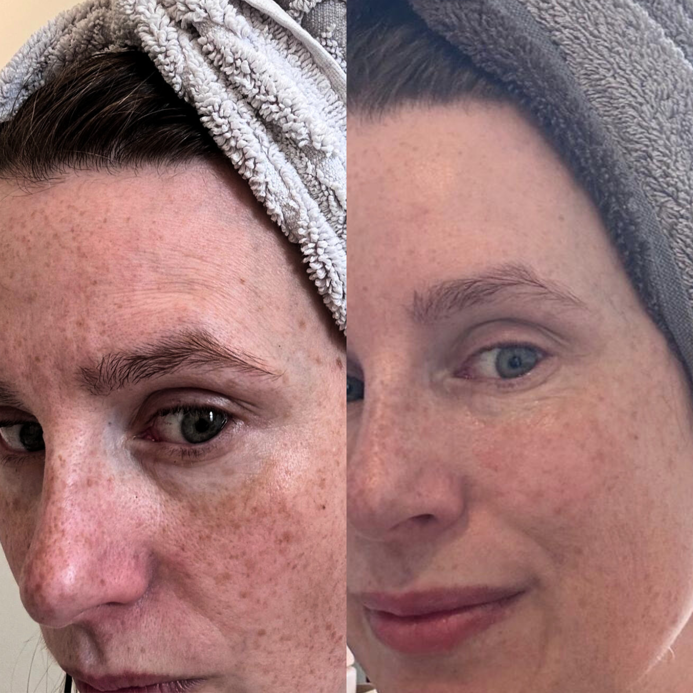 The One - Multi-Active Moisturizer