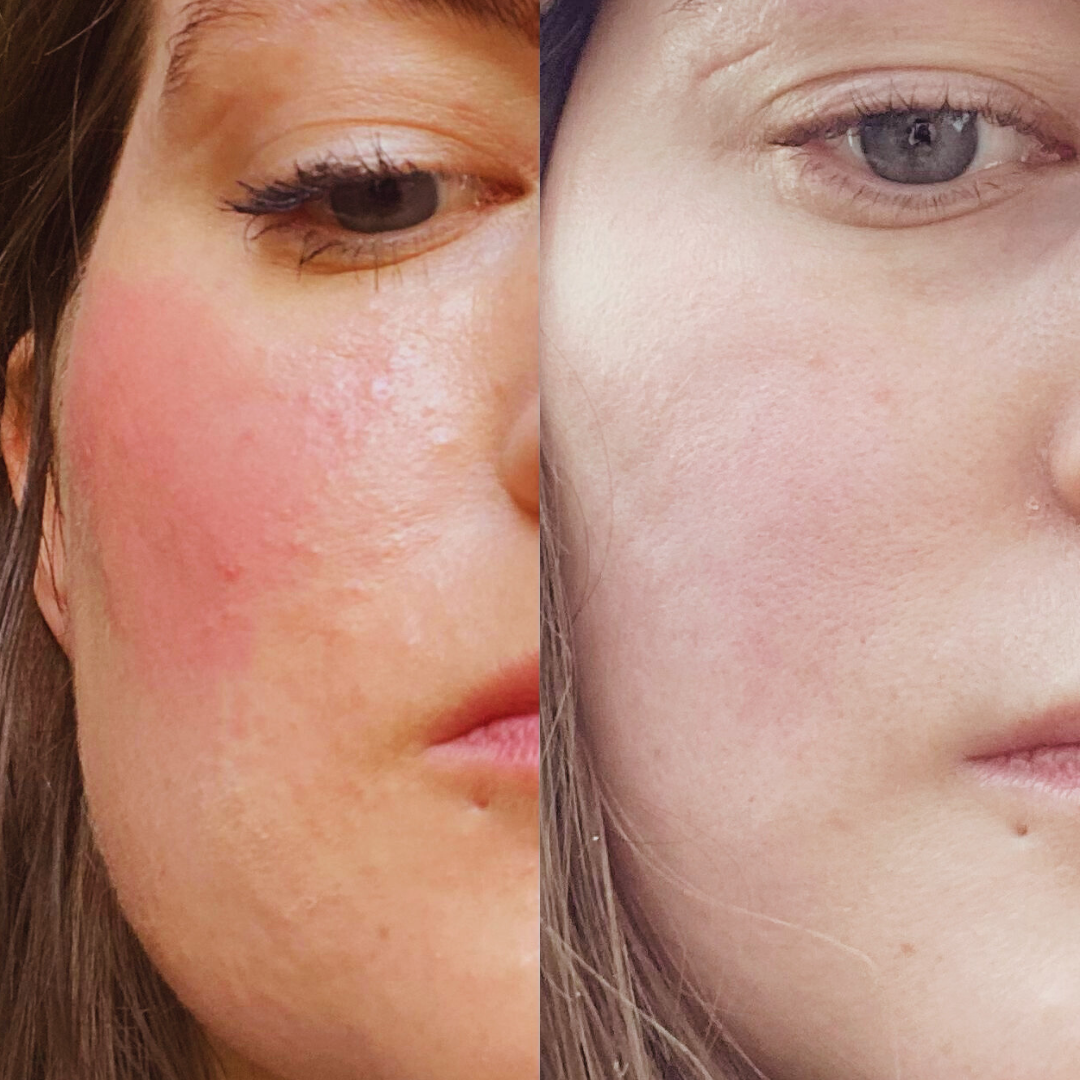 The Zzz - Rejuvenating Concentrate